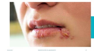 03/8/20XX PRESENTACIÓN DE LANZAMIENTO 27
 