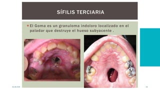 03/8/20XX PRESENTACIÓN DE LANZAMIENTO 34
 