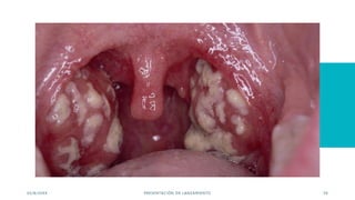 03/8/20XX PRESENTACIÓN DE LANZAMIENTO 39
 