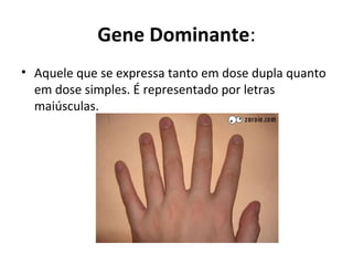 Gene Dominante:
• Aquele que se expressa tanto em dose dupla quanto
em dose simples. É representado por letras
maiúsculas.
 