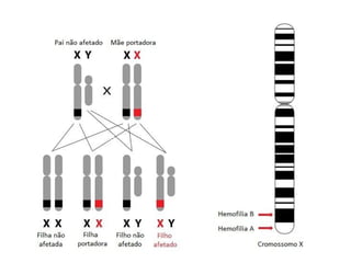 Herança ligada ao sexo
Os cromossomos sexuais são aqueles que
determinam o sexo dos indivíduos. As mulheres
possuem 2 cromossomos X, enquanto os homens
possuem um cromossomo X e um Y. Desse modo,
é o gameta masculino que determina o sexo dos
filhos. Como os cromossomos X tem muito mais
genes o que o Y, alguns dos genes do X não têm
alelo correspondente no Y, desse modo
determinam a herança ligada ao cromossomo
sexual ou ligada ao sexo.
 