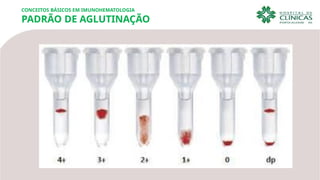 CONCEITOS BÁSICOS EM IMUNOHEMATOLOGIA
PADRÃO DE AGLUTINAÇÃO
 