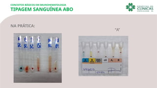 CONCEITOS BÁSICOS EM IMUNOHEMATOLOGIA
TIPAGEM SANGUÍNEA ABO
NA PRÁTICA:
“A”
 