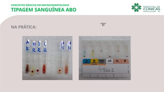 NA PRÁTICA:
“B”
CONCEITOS BÁSICOS EM IMUNOHEMATOLOGIA
TIPAGEM SANGUÍNEA ABO
 