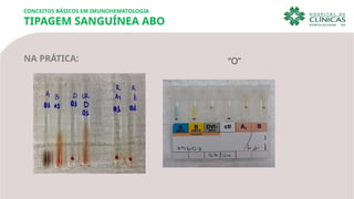NA PRÁTICA: “O”
CONCEITOS BÁSICOS EM IMUNOHEMATOLOGIA
TIPAGEM SANGUÍNEA ABO
 