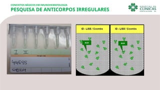 CONCEITOS BÁSICOS EM IMUNOHEMATOLOGIA
PESQUISA DE ANTICORPOS IRREGULARES
 