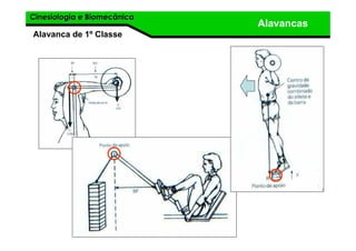 Cinesiologia e BiomecânicaCinesiologia e Biomecânica
Alavancas
Alavanca de 1º Classe
 