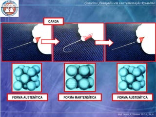Prof. Marco A. Versiani, D.D.S., M.Sc.
Conceitos Avançados em Instrumentação Rotatória
FORMA AUSTENÍTICA FORMA AUSTENÍTICAFORMA MARTENSÍTICA
CARGA
 
