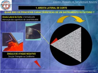 Prof. Marco A. Versiani, D.D.S., M.Sc.
Conceitos Avançados em Instrumentação Rotatória
ÂNGULO DE ATAQUE NEGATIVO
Secção Triangular ou Cordiforme
QUAIS SÃO OS PRINCIPAIS CARACTERÍSTICAS DE UM INSTRUMENTO ROTATÓRIO ?
Aresta Lateral de Corte: é formada pela
interseção das superfícies do canal helicoidal.
1. ARESTA LATERAL DE CORTE
 