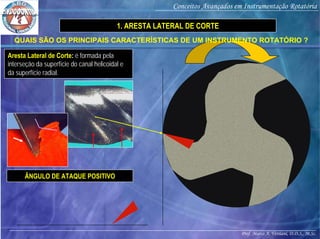 Prof. Marco A. Versiani, D.D.S., M.Sc.
Conceitos Avançados em Instrumentação Rotatória
ÂNGULO DE ATAQUE POSITIVO
Aresta Lateral de Corte: é formada pela
interseção da superfície do canal helicoidal e
da superfície radial.
1. ARESTA LATERAL DE CORTE
QUAIS SÃO OS PRINCIPAIS CARACTERÍSTICAS DE UM INSTRUMENTO ROTATÓRIO ?
 