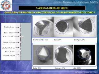 Prof. Marco A. Versiani, D.D.S., M.Sc.
Conceitos Avançados em Instrumentação Rotatória
1. ARESTA LATERAL DE CORTE
QUAIS SÃO OS PRINCIPAIS CARACTERÍSTICAS DE UM INSTRUMENTO ROTATÓRIO ?
 