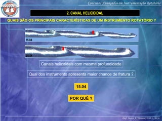 Prof. Marco A. Versiani, D.D.S., M.Sc.
Conceitos Avançados em Instrumentação Rotatória
QUAIS SÃO OS PRINCIPAIS CARACTERÍSTICAS DE UM INSTRUMENTO ROTATÓRIO ?
2. CANAL HELICOIDAL
15.04
25.04
Canais helicoidais com mesma profundidade
Qual dos instrumento apresenta maior chance de fratura ?
15.04
POR QUÊ ?
 