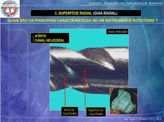 Prof. Marco A. Versiani, D.D.S., M.Sc.
Conceitos Avançados em Instrumentação Rotatória
Superfície ou
Guia Radial
Alívio da
Guia Radial
Haste Helicoidal
QUAIS SÃO OS PRINCIPAIS CARACTERÍSTICAS DE UM INSTRUMENTO ROTATÓRIO ?
3. SUPERFÍCIE RADIAL (GUIA RADIAL)
↓ ATRITO
↑ CANAL HELICOIDAL
 