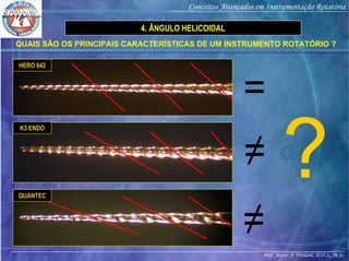 Prof. Marco A. Versiani, D.D.S., M.Sc.
Conceitos Avançados em Instrumentação Rotatória
QUAIS SÃO OS PRINCIPAIS CARACTERÍSTICAS DE UM INSTRUMENTO ROTATÓRIO ?
4. ÂNGULO HELICOIDAL
HERO 642
K3 ENDO
QUANTEC
=
≠
≠
 