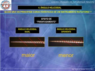Prof. Marco A. Versiani, D.D.S., M.Sc.
Conceitos Avançados em Instrumentação Rotatória
ÂNGULO HELICOIDAL
DIFERENTE
EFEITO DE
“PARAFUSAMENTO”
ÂNGULO HELICOIDAL
IGUAL
maior
QUAIS SÃO OS PRINCIPAIS CARACTERÍSTICAS DE UM INSTRUMENTO ROTATÓRIO ?
4. ÂNGULO HELICOIDAL
menor
 