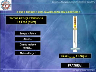 Prof. Marco A. Versiani, D.D.S., M.Sc.
Conceitos Avançados em Instrumentação Rotatória
O QUE É TORQUE E QUAL SUA RELAÇÃO COM A FRATURA ?
Torque = Força x Distância
T = F x d (N.cm)
Torque ≈ Força
Assim...
Quanto maior o
torque...
Maior a Força !
Se a Rtorção < Torque...
FRATURA !
 