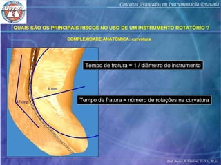 Prof. Marco A. Versiani, D.D.S., M.Sc.
Conceitos Avançados em Instrumentação Rotatória
QUAIS SÃO OS PRINCIPAIS RISCOS NO USO DE UM INSTRUMENTO ROTATÓRIO ?
COMPLEXIDADE ANATÔMICA: curvaturaCOMPLEXIDADE ANATÔMICA: curvatura
Tempo de fratura ≈ 1 / diâmetro do instrumento
Tempo de fratura ≈ número de rotações na curvatura
 