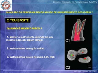 Prof. Marco A. Versiani, D.D.S., M.Sc.
Conceitos Avançados em Instrumentação Rotatória
QUAIS SÃO OS PRINCIPAIS RISCOS NO USO DE UM INSTRUMENTO ROTATÓRIO ?
2. TRANSPORTE
QUANDO É MAIOR O RISCO ?QUANDO É MAIOR O RISCO ?
1. Manter o instrumento girando em um
mesmo local, por algum tempo;
1. Manter o instrumento girando em um
mesmo local, por algum tempo;
2. Instrumentos sem guia radial;2. Instrumentos sem guia radial;
3. Instrumentos pouco flexíveis (.04, .06);3. Instrumentos pouco flexíveis (.04, .06);
 