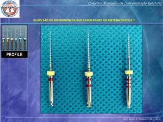 Prof. Marco A. Versiani, D.D.S., M.Sc.
Conceitos Avançados em Instrumentação Rotatória
QUAIS SÃO OS INSTRUMENTOS QUE FAZEM PARTE DO SISTEMA PROFILE ?
PROFILE
 
