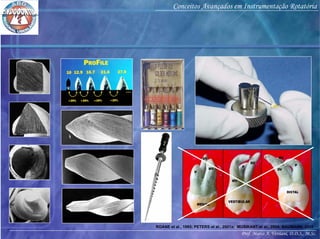 Prof. Marco A. Versiani, D.D.S., M.Sc.
Conceitos Avançados em Instrumentação Rotatória
ROANE et al., 1985; PETERS et al., 2001a; MUSIKANT et al., 2004; BAUMANN, 2005
 