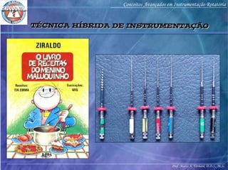 Prof. Marco A. Versiani, D.D.S., M.Sc.
Conceitos Avançados em Instrumentação Rotatória
TÉCNICA HÍBRIDA DE INSTRUMENTAÇÃOTÉCNICA HÍBRIDA DE INSTRUMENTAÇÃO
 