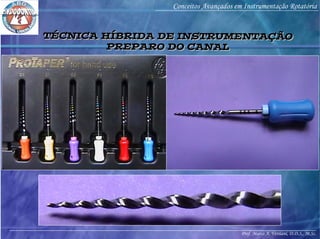 Prof. Marco A. Versiani, D.D.S., M.Sc.
Conceitos Avançados em Instrumentação Rotatória
TÉCNICA HÍBRIDA DE INSTRUMENTAÇÃO
PREPARO DO CANAL
TÉCNICA HÍBRIDA DE INSTRUMENTAÇÃO
PREPARO DO CANAL
 