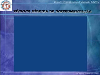 Prof. Marco A. Versiani, D.D.S., M.Sc.
Conceitos Avançados em Instrumentação Rotatória
TÉCNICA HÍBRIDA DE INSTRUMENTAÇÃOTÉCNICA HÍBRIDA DE INSTRUMENTAÇÃO
 