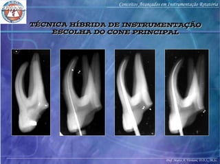 Prof. Marco A. Versiani, D.D.S., M.Sc.
Conceitos Avançados em Instrumentação Rotatória
TÉCNICA HÍBRIDA DE INSTRUMENTAÇÃO
ESCOLHA DO CONE PRINCIPAL
TÉCNICA HÍBRIDA DE INSTRUMENTAÇÃO
ESCOLHA DO CONE PRINCIPAL
 
