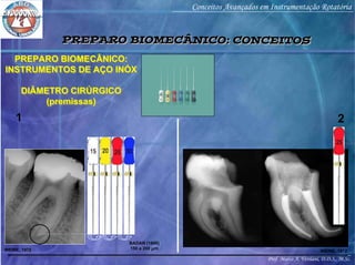 Prof. Marco A. Versiani, D.D.S., M.Sc.
Conceitos Avançados em Instrumentação Rotatória
PREPARO BIOMECÂNICO:
INSTRUMENTOS DE AÇO INÓX
DIÂMETRO CIRÚRGICO
(premissas)
PREPARO BIOMECÂNICO:
INSTRUMENTOS DE AÇO INÓX
DIÂMETRO CIRÚRGICO
(premissas)
WEINE, 1972
BADAN (1949)
150 a 200 µm
1 2
WEINE, 1972
PREPARO BIOMECÂNICO: CONCEITOSPREPARO BIOMECÂNICO: CONCEITOS
 