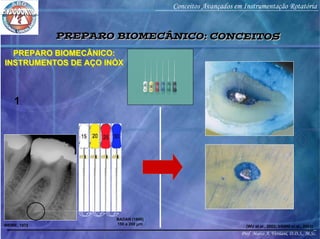 Prof. Marco A. Versiani, D.D.S., M.Sc.
Conceitos Avançados em Instrumentação Rotatória
PREPARO BIOMECÂNICO:
INSTRUMENTOS DE AÇO INÓX
PREPARO BIOMECÂNICO:
INSTRUMENTOS DE AÇO INÓX
WEINE, 1972
BADAN (1949)
150 a 200 µm
1
(WU et al., 2002; VANNI et al., 2005)
PREPARO BIOMECÂNICO: CONCEITOSPREPARO BIOMECÂNICO: CONCEITOS
 