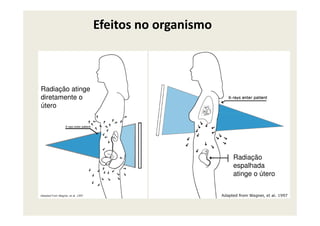 Efeitos no organismo
Radiação atinge
diretamente o
útero
Radiação
espalhada
atinge o útero
 