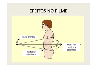 EFEITOS NO FILME
Fonte primária
Radiação
espalhada
Radiação
primária +
espalhada
 