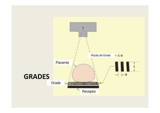 Razão de Grade
GRADES
Paciente
Grade
Receptor
Razão de Grade
 