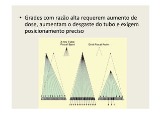 • Grades com razão alta requerem aumento de
dose, aumentam o desgaste do tubo e exigem
posicionamento preciso
 