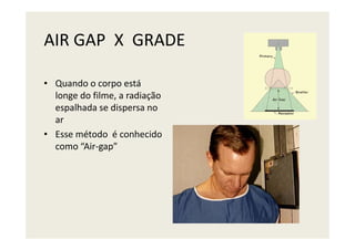 AIR GAP X GRADE
• Quando o corpo está
longe do filme, a radiação
espalhada se dispersa no
ar
• Esse método é conhecido
como “Air-gap”
 