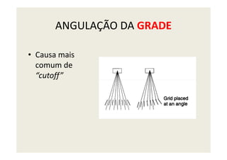 ANGULAÇÃO DA GRADE
• Causa mais
comum de
“cutoff”
 