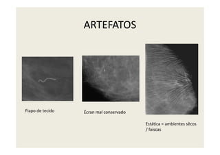 ARTEFATOS
Estática = ambientes sêcos
/ faíscas
Fiapo de tecido Écran mal conservado
 