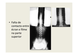 • Falta de
contacto entre
écran e filme
na parte
superior
 