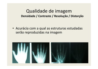 Qualidade de imagem
• Acurácia com a qual as estruturas estudadas
serão reproduzidas na imagem
Densidade / Contraste / Resolução / Distorção
 