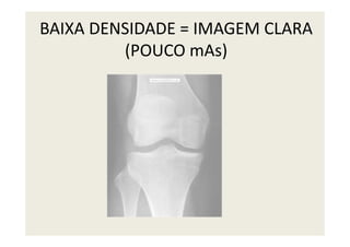 BAIXA DENSIDADE = IMAGEM CLARA
(POUCO mAs)
 