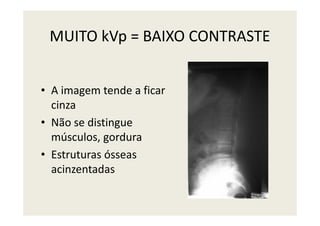 MUITO kVp = BAIXO CONTRASTE
• A imagem tende a ficar
cinza
• Não se distingue
músculos, gordura
• Estruturas ósseas
acinzentadas
 