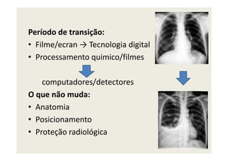 Período de transição:
• Filme/ecran → Tecnologia digital
• Processamento quimico/filmes
computadores/detectorescomputadores/detectores
O que não muda:
• Anatomia
• Posicionamento
• Proteção radiológica
 