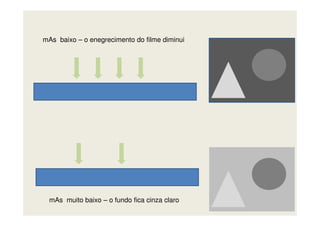 mAs baixo – o enegrecimento do filme diminui
mAs muito baixo – o fundo fica cinza claro
 
