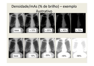 Densidade/mAs (% de brilho) – exemplo
ilustrativo
base + 10% + 40%+ 20% + 70%
base - 10% - 80%- 40%- 20%
 