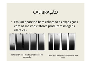 CALIBRAÇÃO
• Em um aparelho bem calibrado as exposições
com os mesmos fatores produzem imagens
idênticas
Falta calibração – muita variabilidade na
exposição
Calibração adequada - exposição não
varia
 