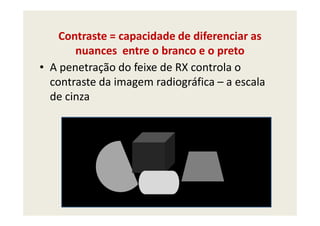 Contraste = capacidade de diferenciar as
nuances entre o branco e o preto
• A penetração do feixe de RX controla o
contraste da imagem radiográfica – a escala
de cinza
 