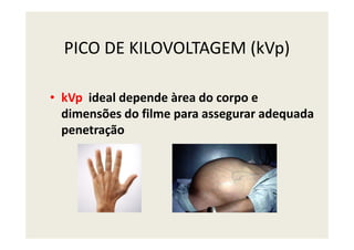 PICO DE KILOVOLTAGEM (kVp)
• kVp ideal depende àrea do corpo e
dimensões do filme para assegurar adequada
penetraçãopenetração
 