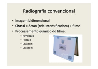 Radiografia convencional
• Imagem bidimensional
• Chassi = écran (tela intensificadora) + filme
• Processamento químico do filme:
• Revelação• Revelação
• Fixação
• Lavagem
• Secagem
 