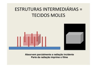 ESTRUTURAS INTERMEDIÁRIAS =
TECIDOS MOLES
Absorvem parcialmente a radiação incidente
Parte da radiação imprime o filme
 