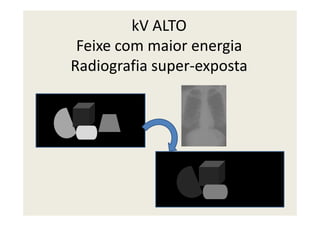 kV ALTO
Feixe com maior energia
Radiografia super-exposta
 